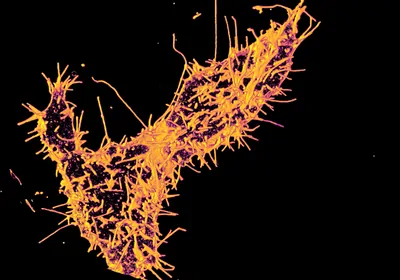 A mutated cell with a spiky membrane